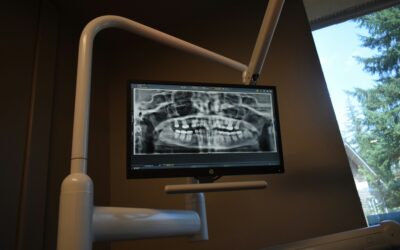 Digital Dental X-Ray Upgrades Every Growing Practice Should Consider